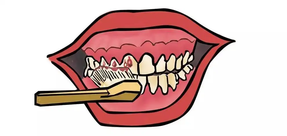 牙周病自测表，你中了几条？